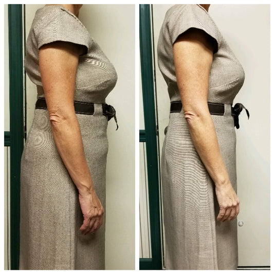 Neveskin Shape - 5 Sessions