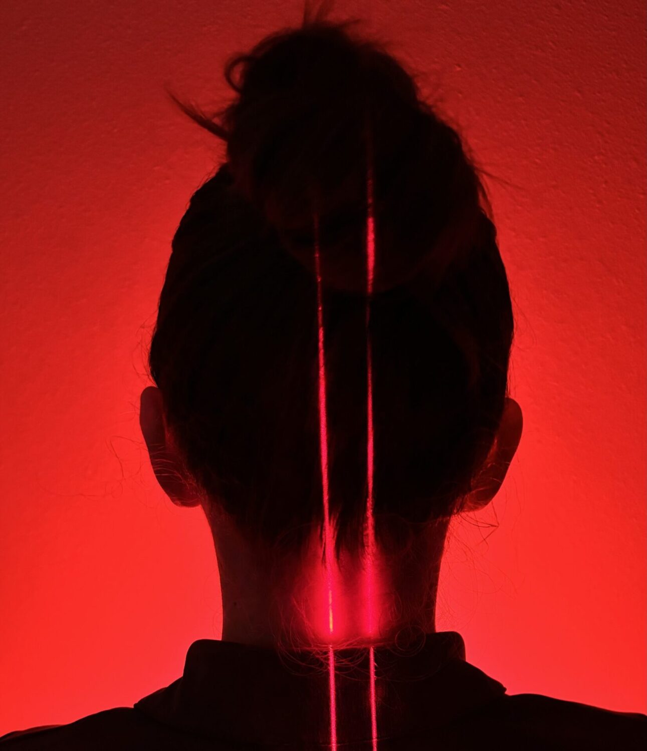 Low Level Laser Therapy - 10 Sessions